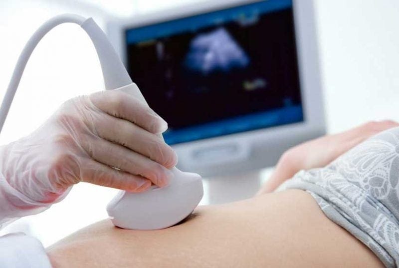 first ultrasound for first trimester things to do during your pregnancy